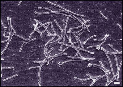 Bacterium Thermus aquaticus (Click image to view full size.) Bacterium Thermus aquaticus (Click image to view full size.)